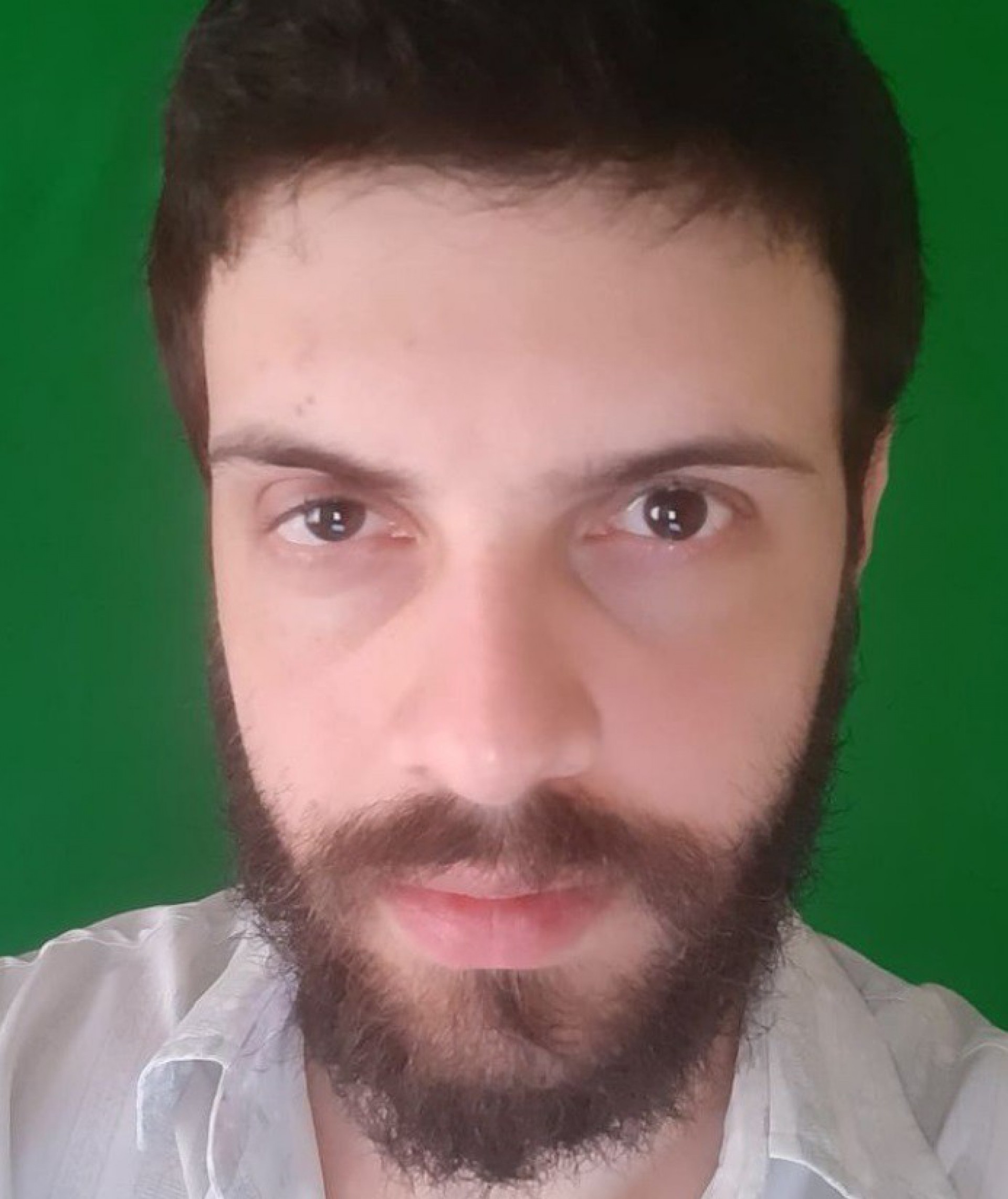 Diego Defante se machuca após pular do palco e ninguém o segurar - reprodução