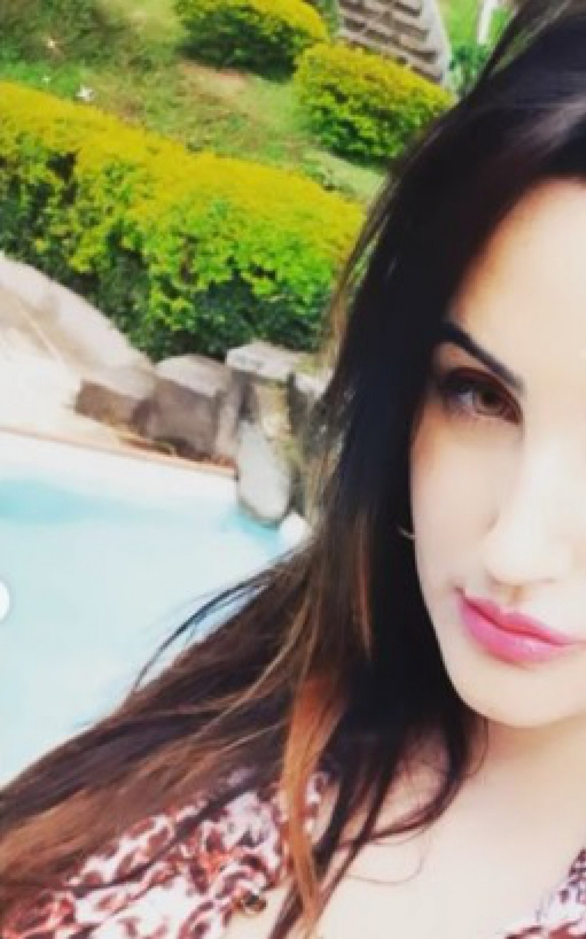 Cintia se sentiu mal ap&oacute;s aplica&ccedil;&atilde;o de  polimetilmetacrilato nos gl&uacute;teos