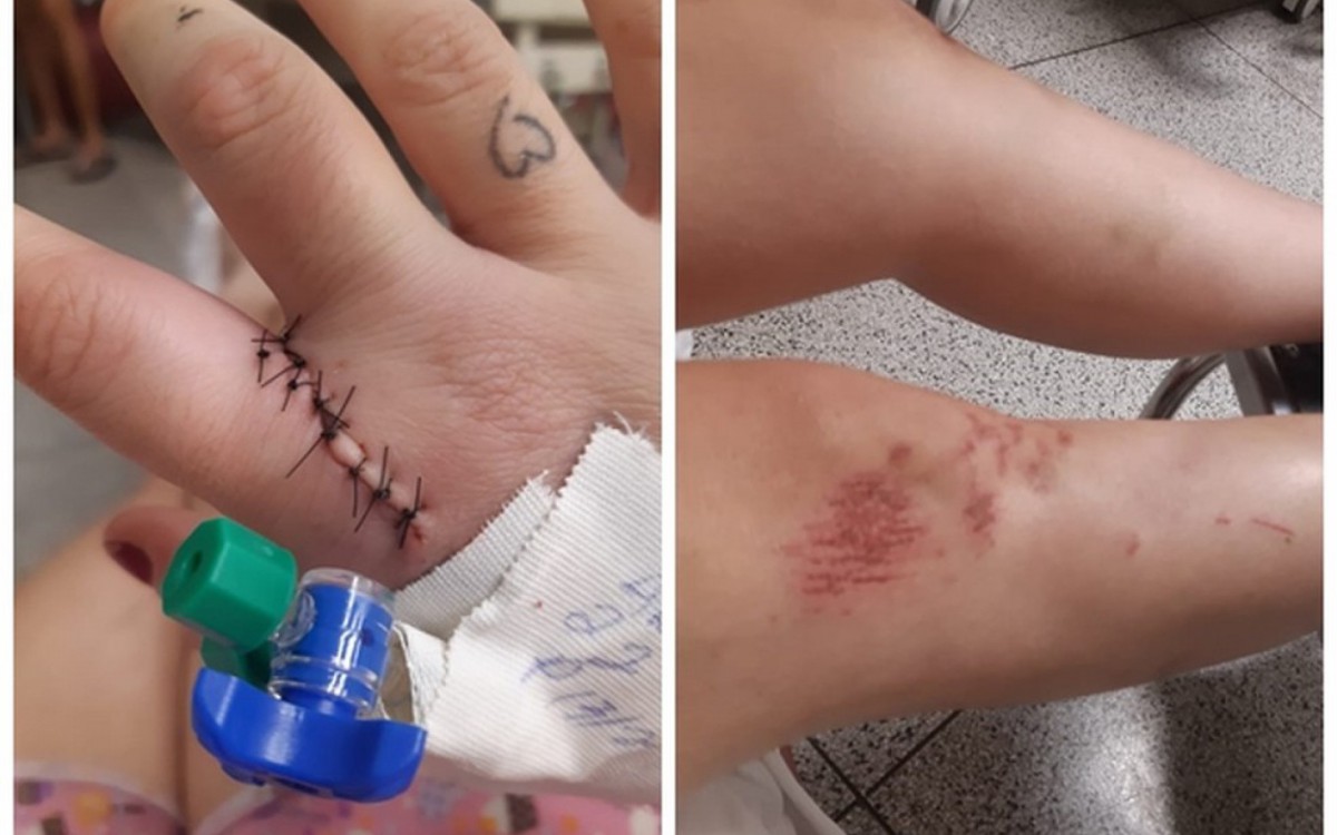 A v&iacute;tima teve escoria&ccedil;&otilde;es pelas pernas, al&eacute;m de diversos outros ferimentos