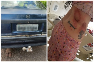 Mulher é amarrada a engate de carro e arrastada pelo namorado 