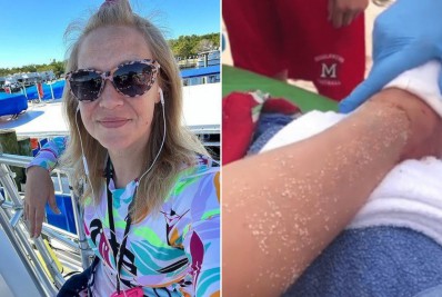 Mulher escapa de ataque de tubarão após atingir animal com socos na cabeça