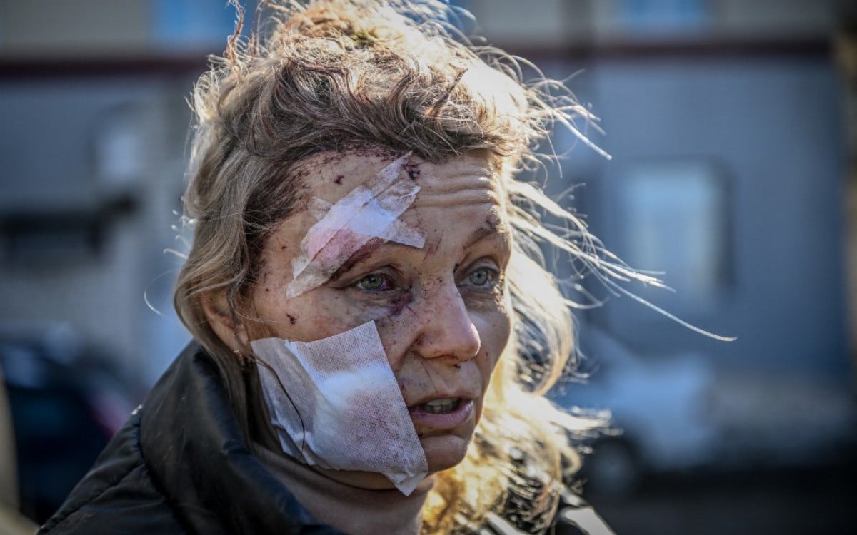 Uma mulher ferida fica do lado de fora de um hospital após o bombardeio da cidade de Chuguiv, no leste da Ucrânia - ARIS MESSINIS / AFP