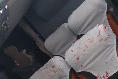 Imagem forte! Veja foto de como ficou o goleiro Danilo Fernandes após vândalos jogarem bomba no ônibus do Bahia