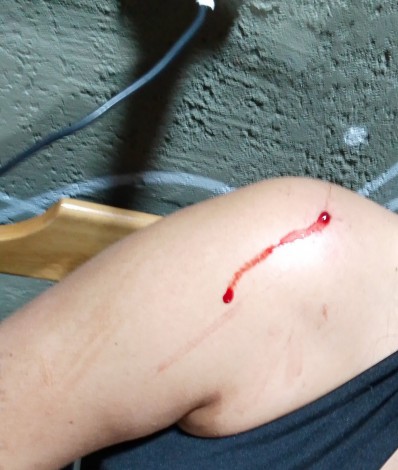 Renata Assis, de 22 anos, foi baleada durante um evento de pagode em Rocha Miranda, na Zona Norte do Rio - Divulgação/Redes Sociais