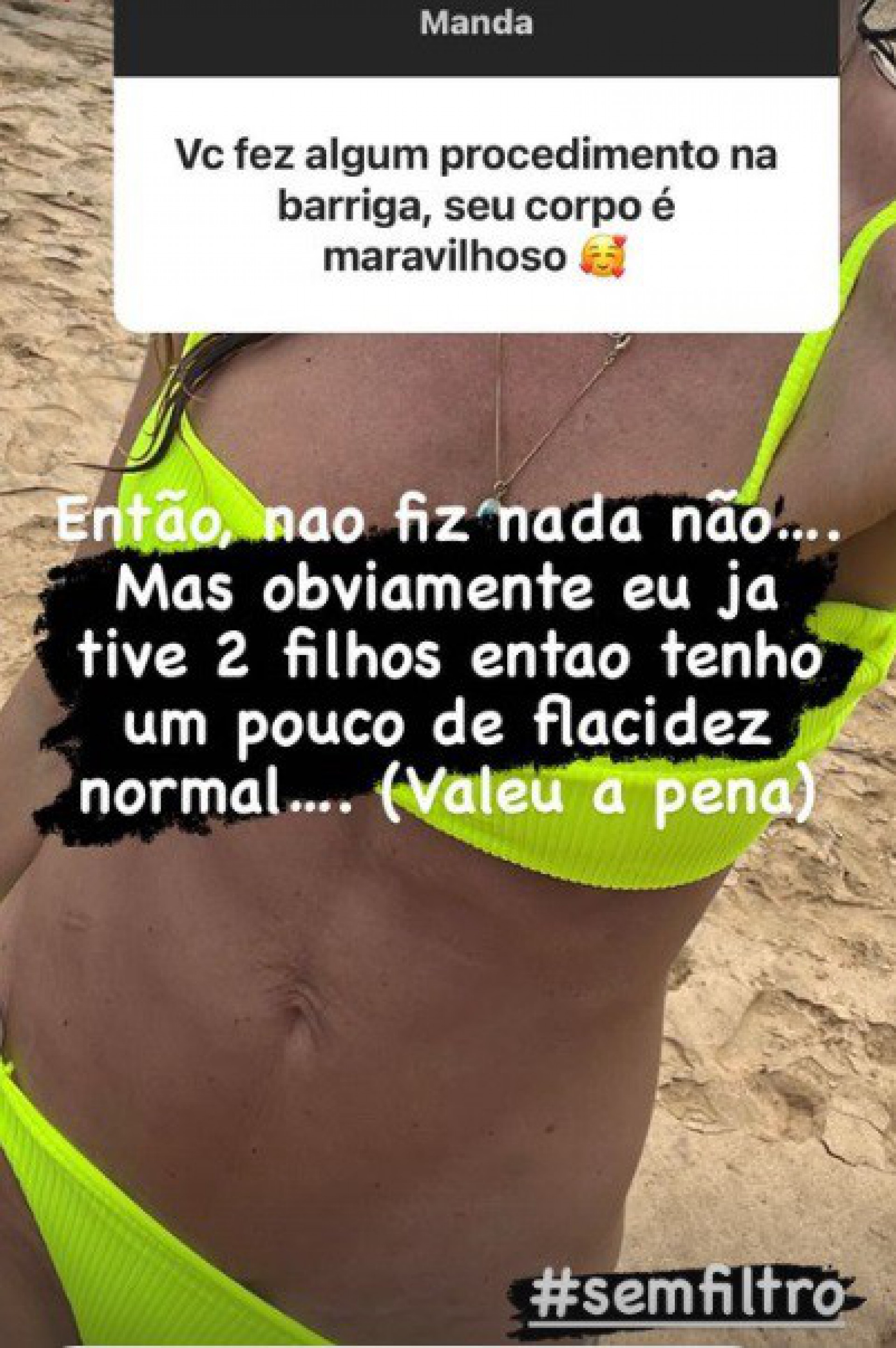  - Reprodução/Instagram