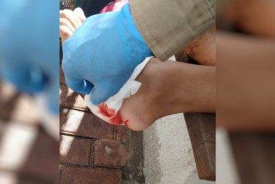 Turista é atacado por piranhas em lago de Caldas Novas