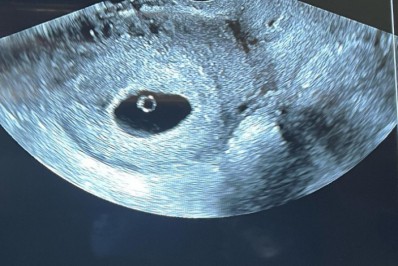 Virgínia Fonseca compartilha ultrassom do segundo filho