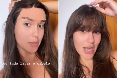 Ex-BBB Thais mostra cicatrizes após diminuir a testa