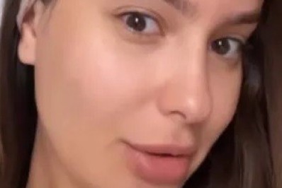 Após cirurgia, Thais Braz exibe a testa sem curativos; veja! 