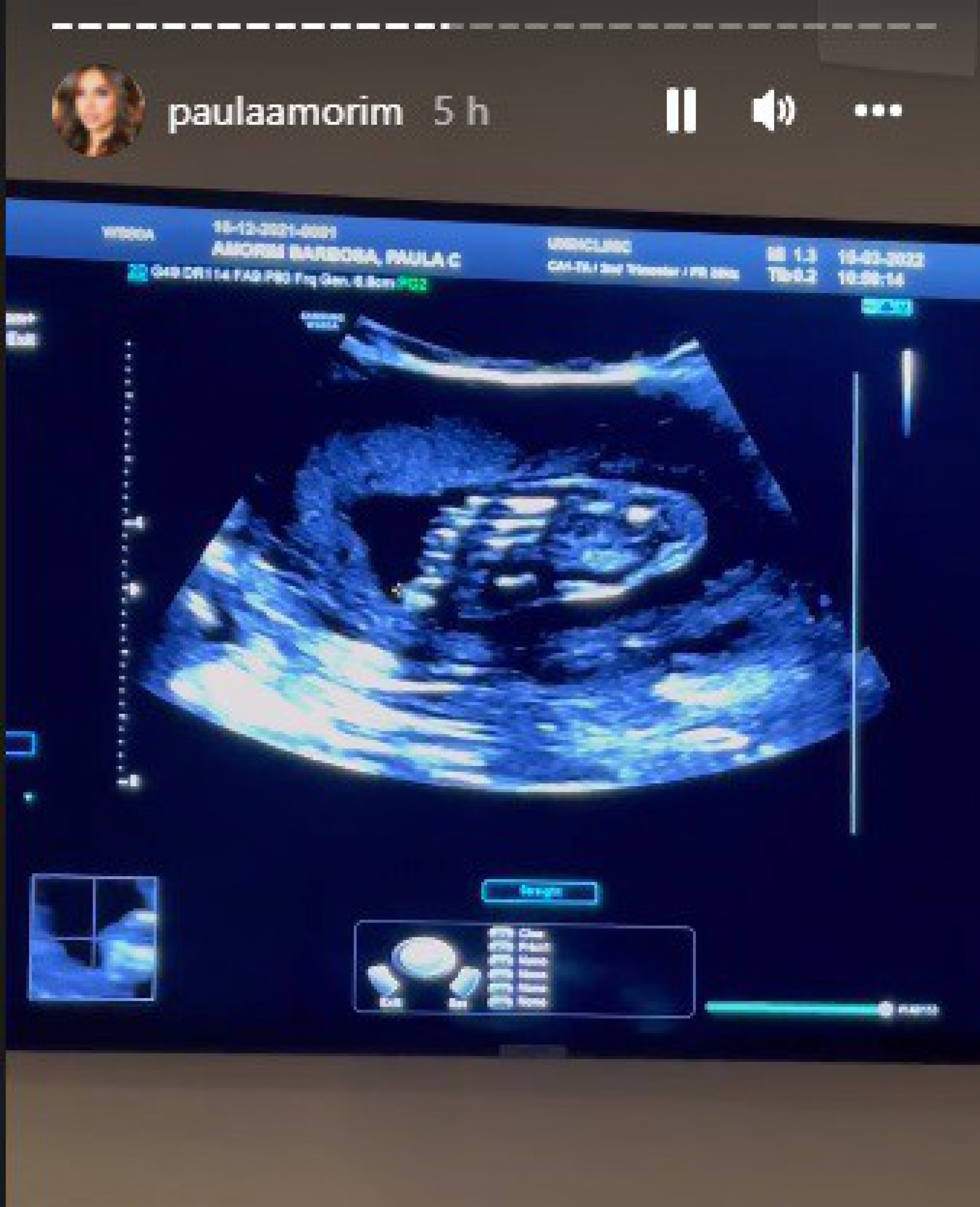 Paula Amorim compartilhou fotos do ultrassom do filho - Reprodução 