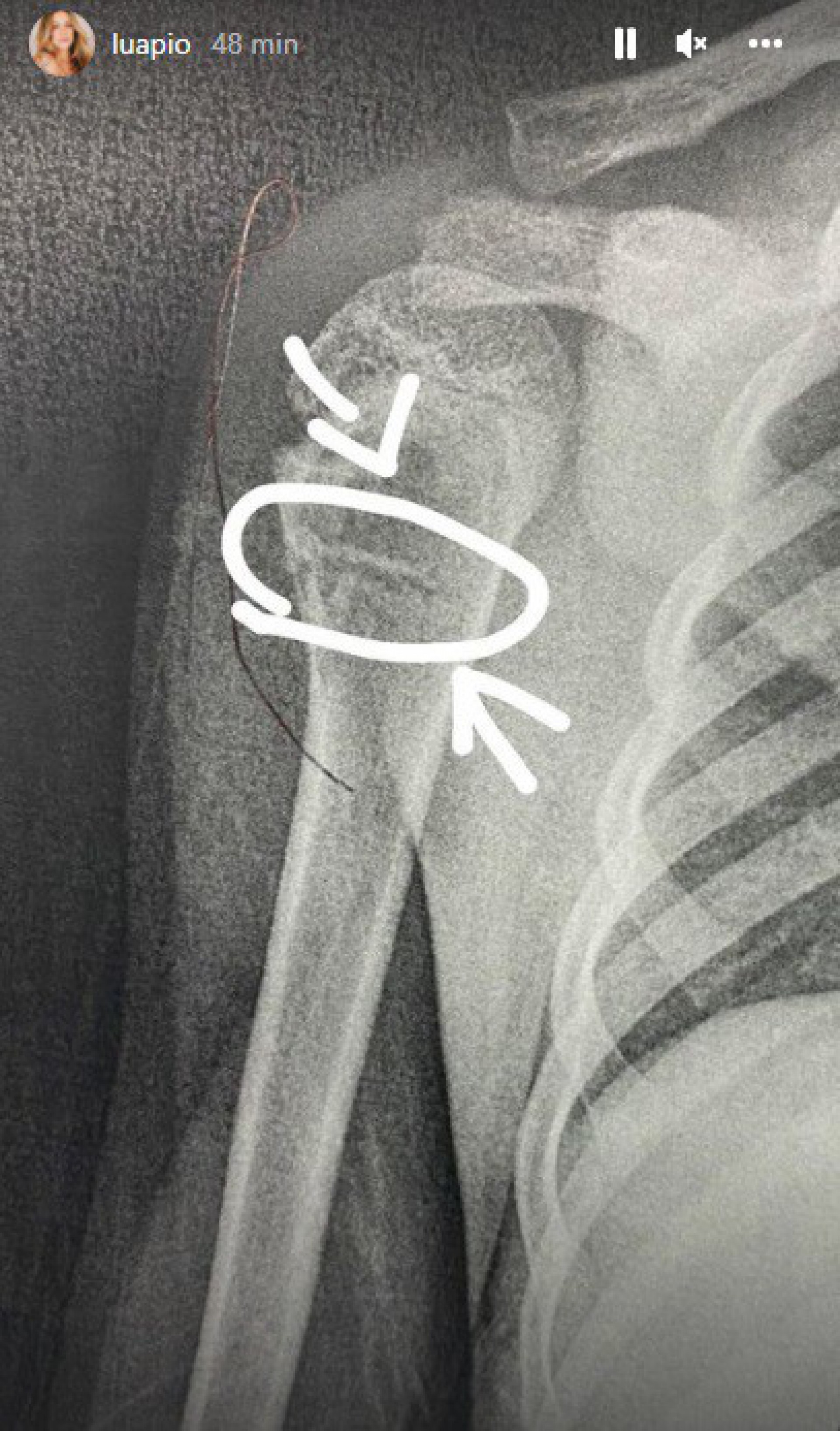 Luana Piovani comenta queda do filho  - Reprodução/Instagram