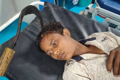 Jovem cai de cama e tem foice cravada na cabeça