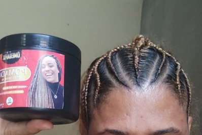 Manicure sofre lesão na córnea após usar pomada capilar para tranças