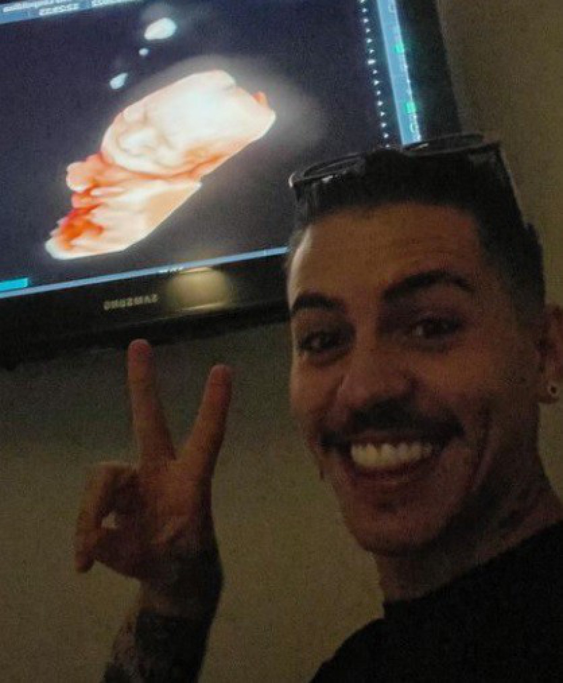 Biel mostra imagens do ultrassom da filha  - Reprodução