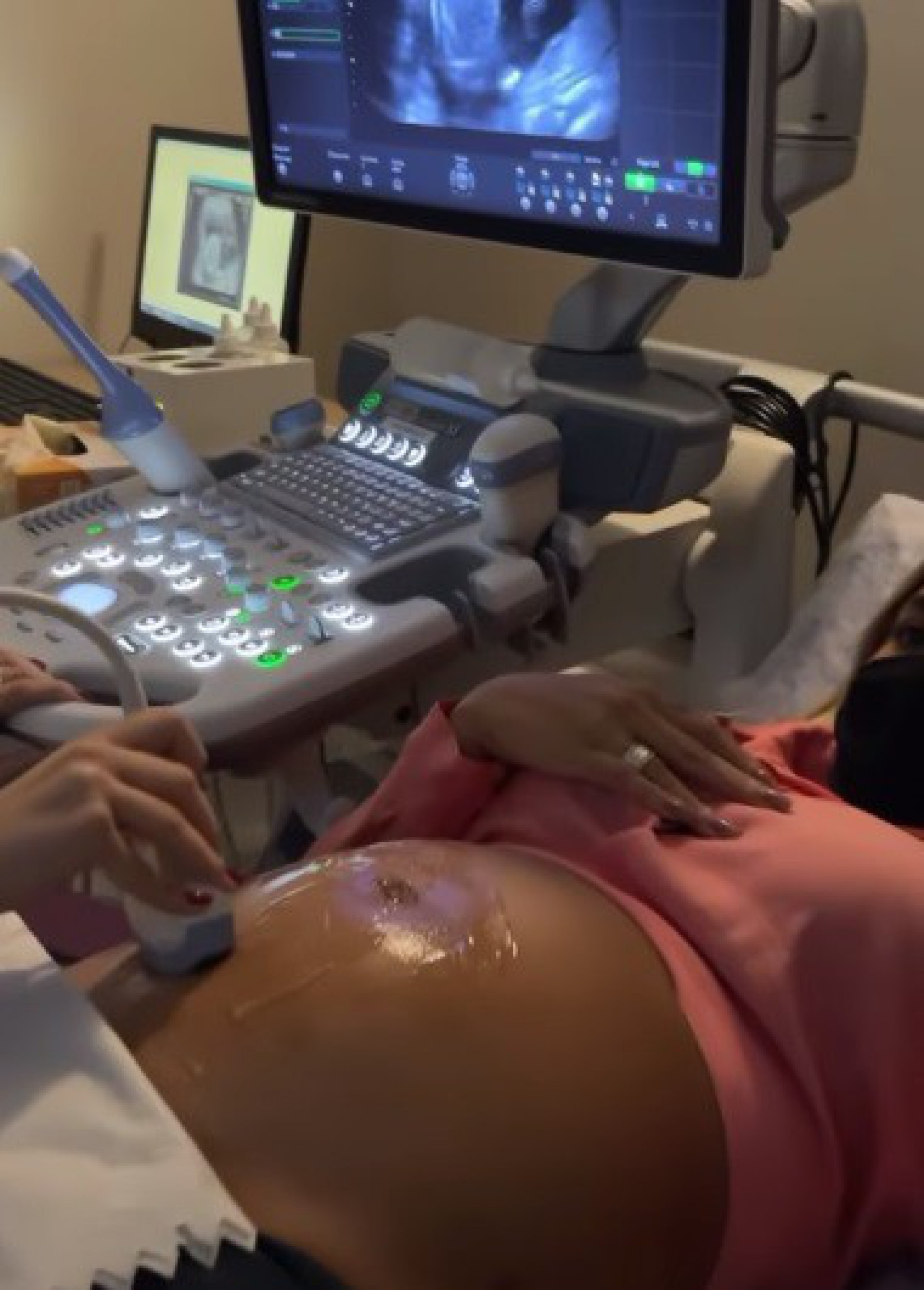 Biel mostra imagens do ultrassom da filha  - Reprodução