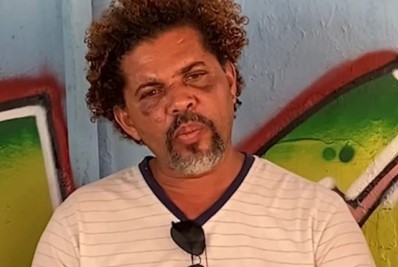 Sem-teto espancado por personal diz que chegou a pensar que foi usado pela mulher