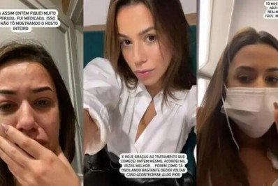 Ex-BBB Larissa tem crise alérgica e preocupa fãs