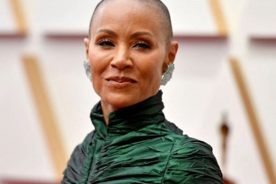 Entenda o que é e como tratar a alopecia feminina: a doença da mulher de Will Smith