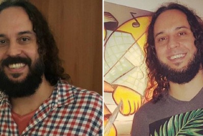 Assim como a mulher de Will Smith, Gabriel O Pensador revela que também tem alopecia