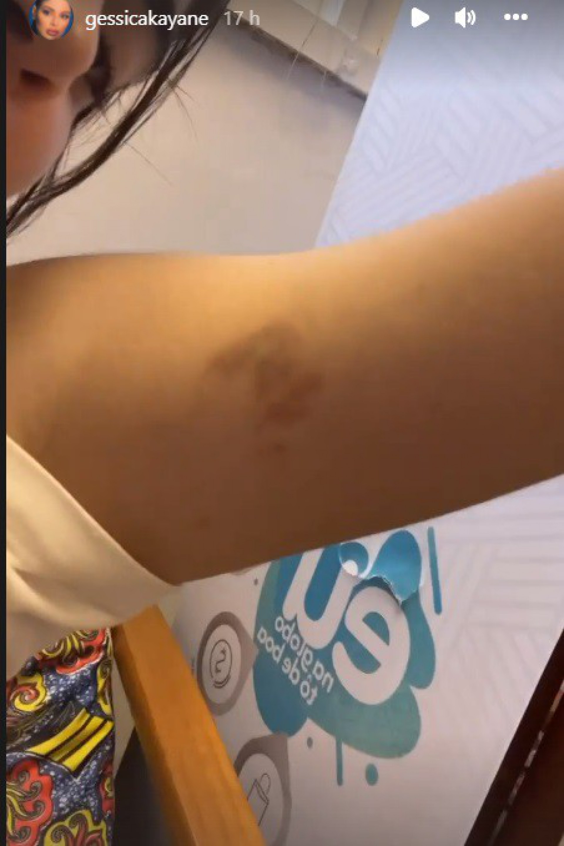 Gkay mostra roxos no corpo por conta dos ensaios do 'Dança dos Famosos' - reprodução de vídeo