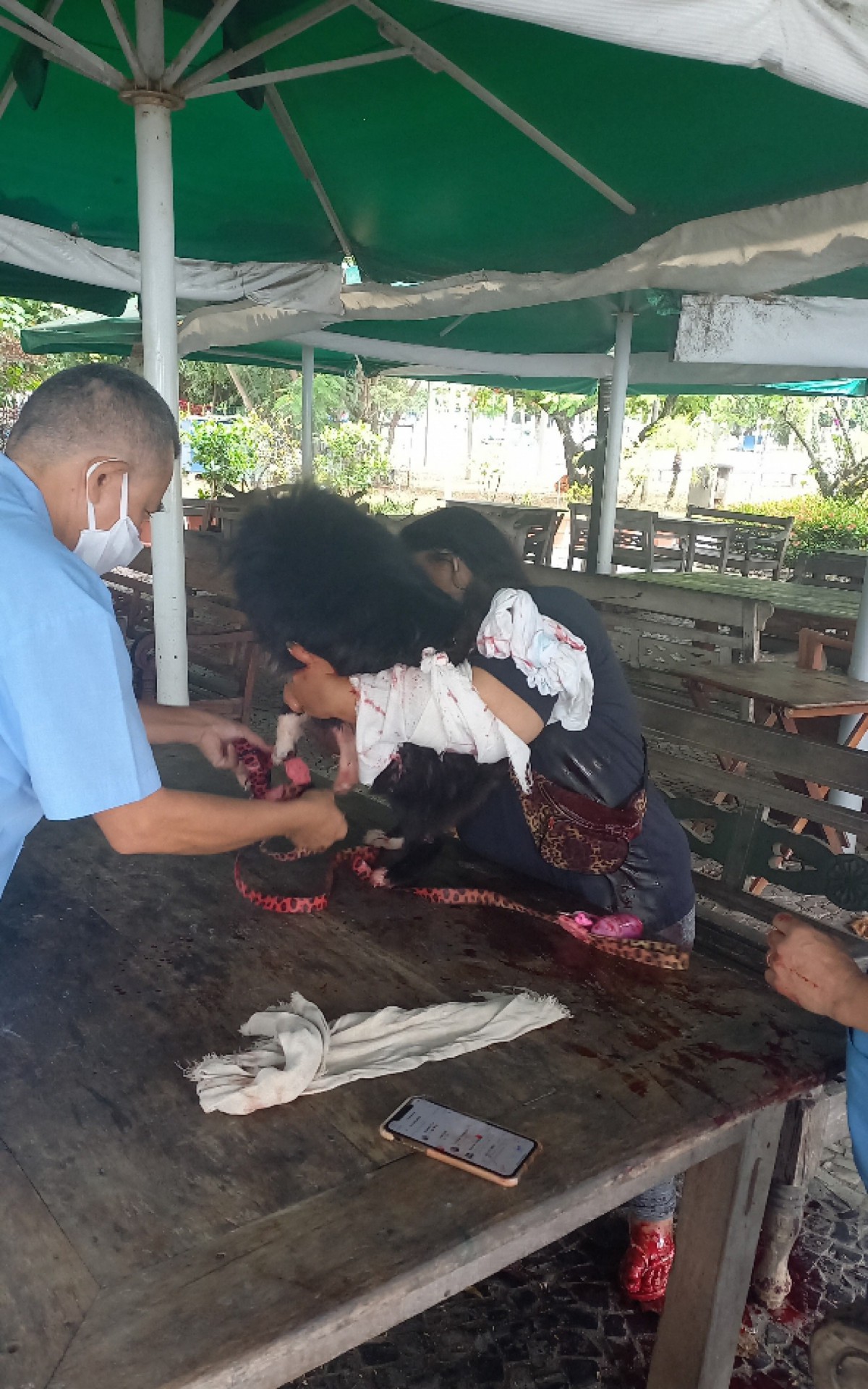 Mulher é atacada por capivara na Lagoa - Foto: JC Pereira / AGNEWS