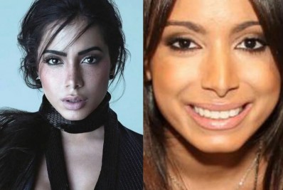 Anitta ostenta suas diferentes 'versões' na web: 'Depois de milhões de plásticas'
