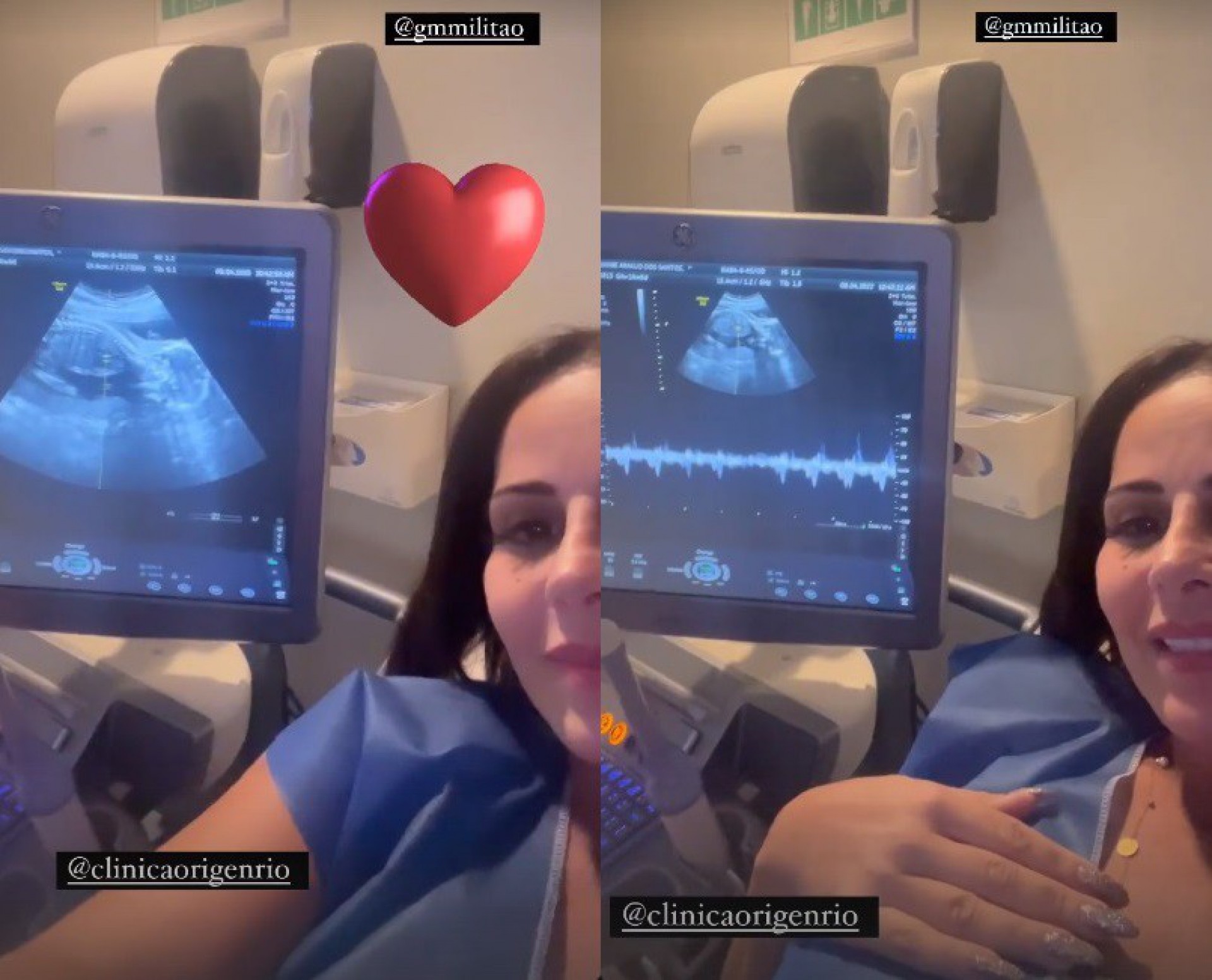 Viviane Araújo mostra ultrassom do filho  - Reprodução/Instagram