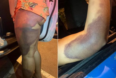 Justiça nega habeas corpus de mulher suspeita de manter nora em cárcere privado