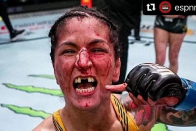Lutadora perde dois dentes, mas consegue vitória no UFC: 'Tudo sangrando'