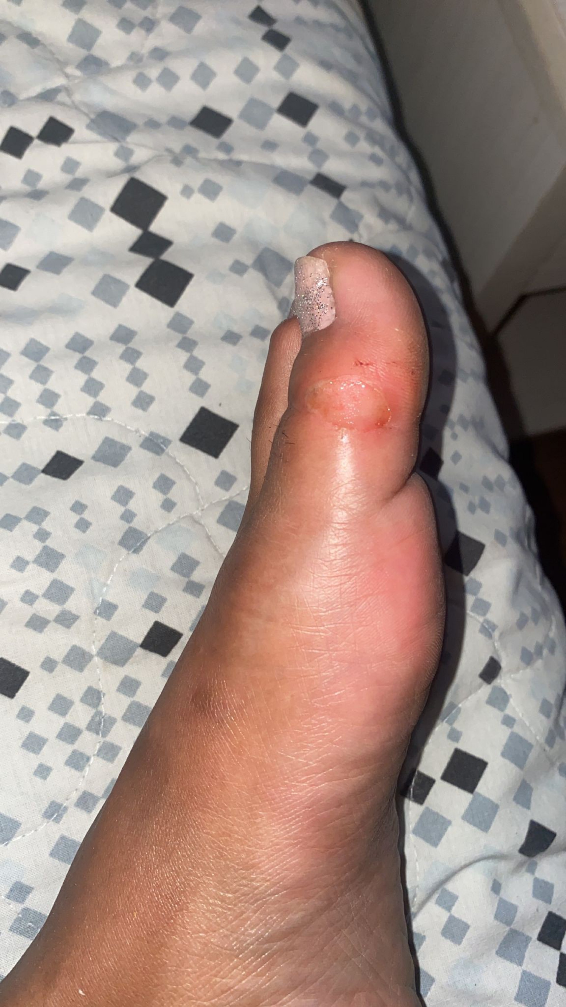 Rainha de bateria da Unidos da Ponte, Carolina Lekker revelou hematomas após desfile na Sapucaí - Divulgação / CO Assessoria