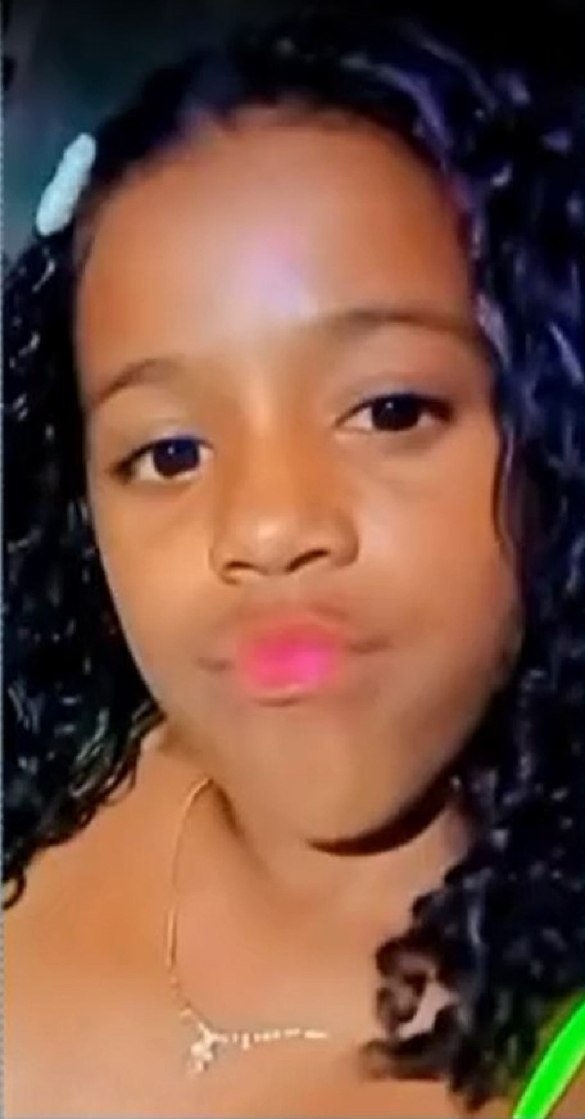 Raquel, de 11 anos, passou por cirurgia, mas não resistiu - Reprodução