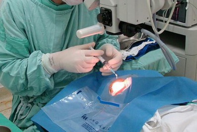 Mutirão de cirurgias de catarata promovido pela Prefeitura de Búzios zera fila de espera no município