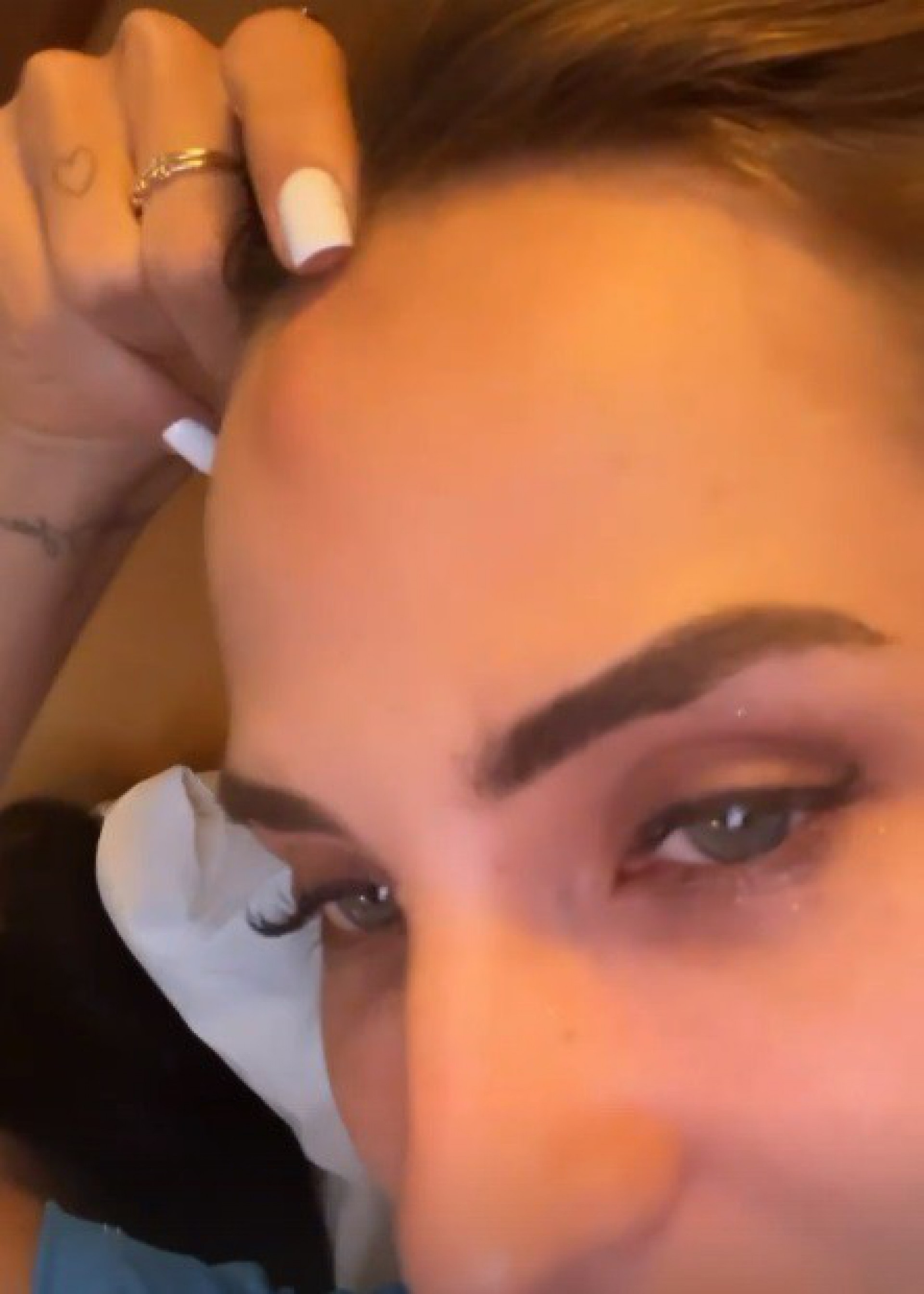 Gabi Martins mostra machucado na testa após desfile - reprodução do instagram