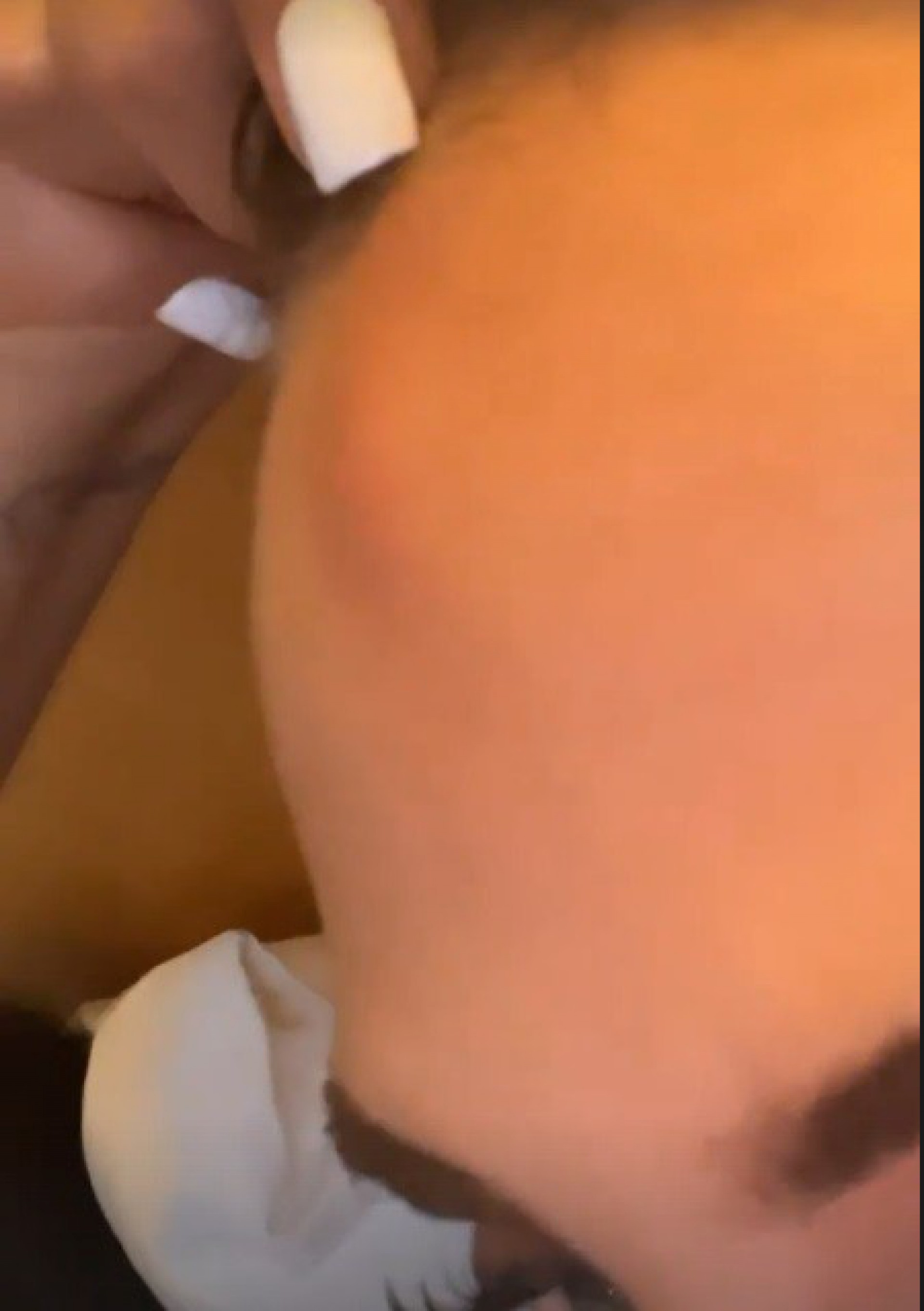 Gabi Martins mostra machucado na testa após desfile - reprodução do instagram