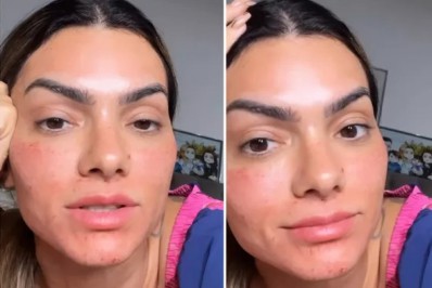 Kelly Key afirma aplicar botox desde os 25 anos