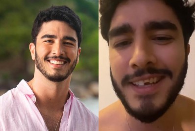 Leonardo Bittencourt quebra dente pela metade e brinca: 'Decidi inovar'