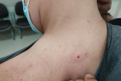 Mulher é atingida por bala de chumbinho na Praça Paris, na Glória