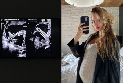 Grávida, Isabella Scherer faz ultrassom dos gêmeos e compartilha nas redes: 'Estão enormes'