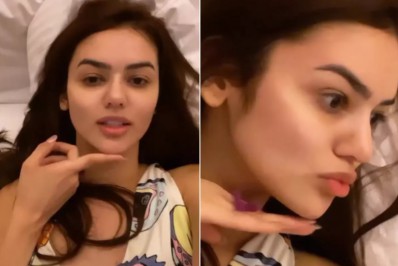 Ex-BBB  Eslovênia faz harmonização facial: 'Amei tanto'