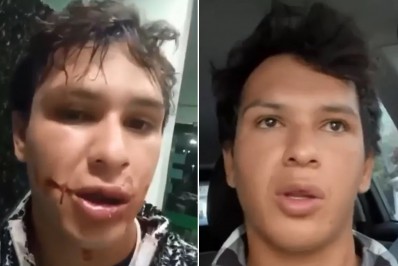 Repórter do SBT é assaltado e agredido após show