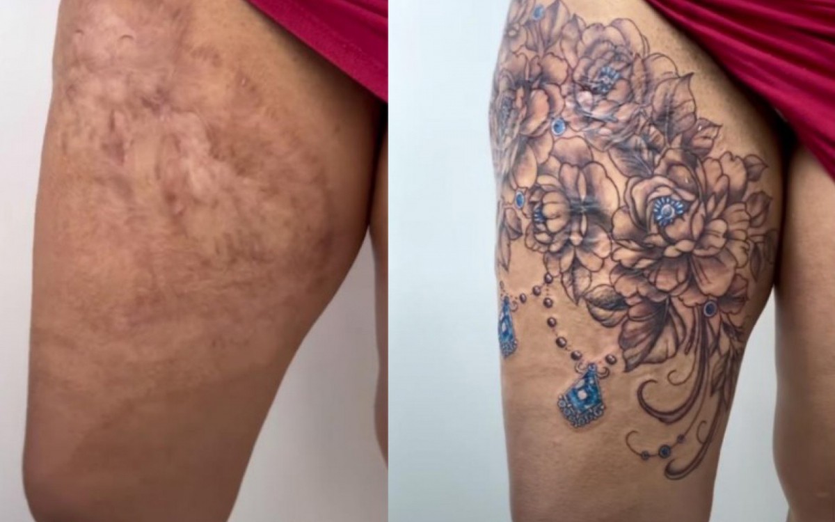 Tattoo Week: tatuagem para cobertura de cicatrizes irrevers&iacute;veis de mulheres, pelo projeto "We are Diamonds", da tatuadora Karlla Mendes