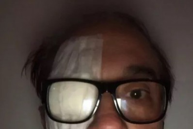 Vocalista do Biquíni Cavadão passa por procedimento para retirar tumor na pálpebra