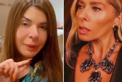 Mara Maravilha faz procedimento estético no nariz e cita polêmica com Adriane Galisteu