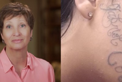 Sônia Bridi oferece suporte para jovem que teve rosto tatuado pelo ex-namorado