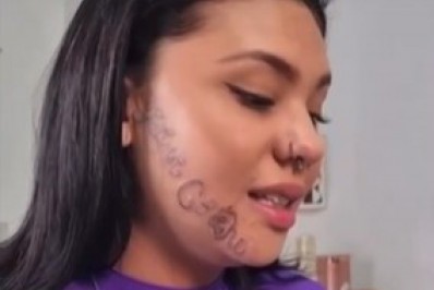 Jovem que teve o rosto tatuado a força pelo ex-namorado começa procedimento de remoção