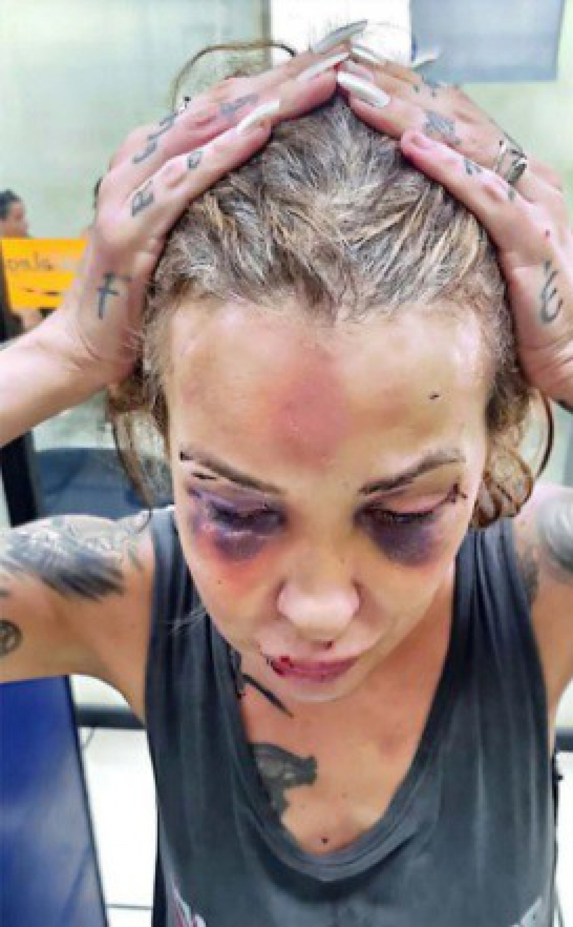 A vítima sofreu traumatismo craniano e fratura na mandíbula  - Polícia Civil / Divulgação