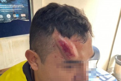 Vídeo: policial é atingido com tijolada na cabeça por estudante da Zona Norte