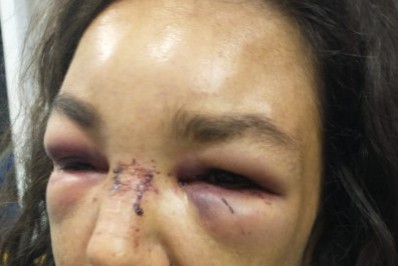 Guarda que agrediu esposa responde a duas sindicâncias na prefeitura de Cabo Frio e pode ser desligado do cargo