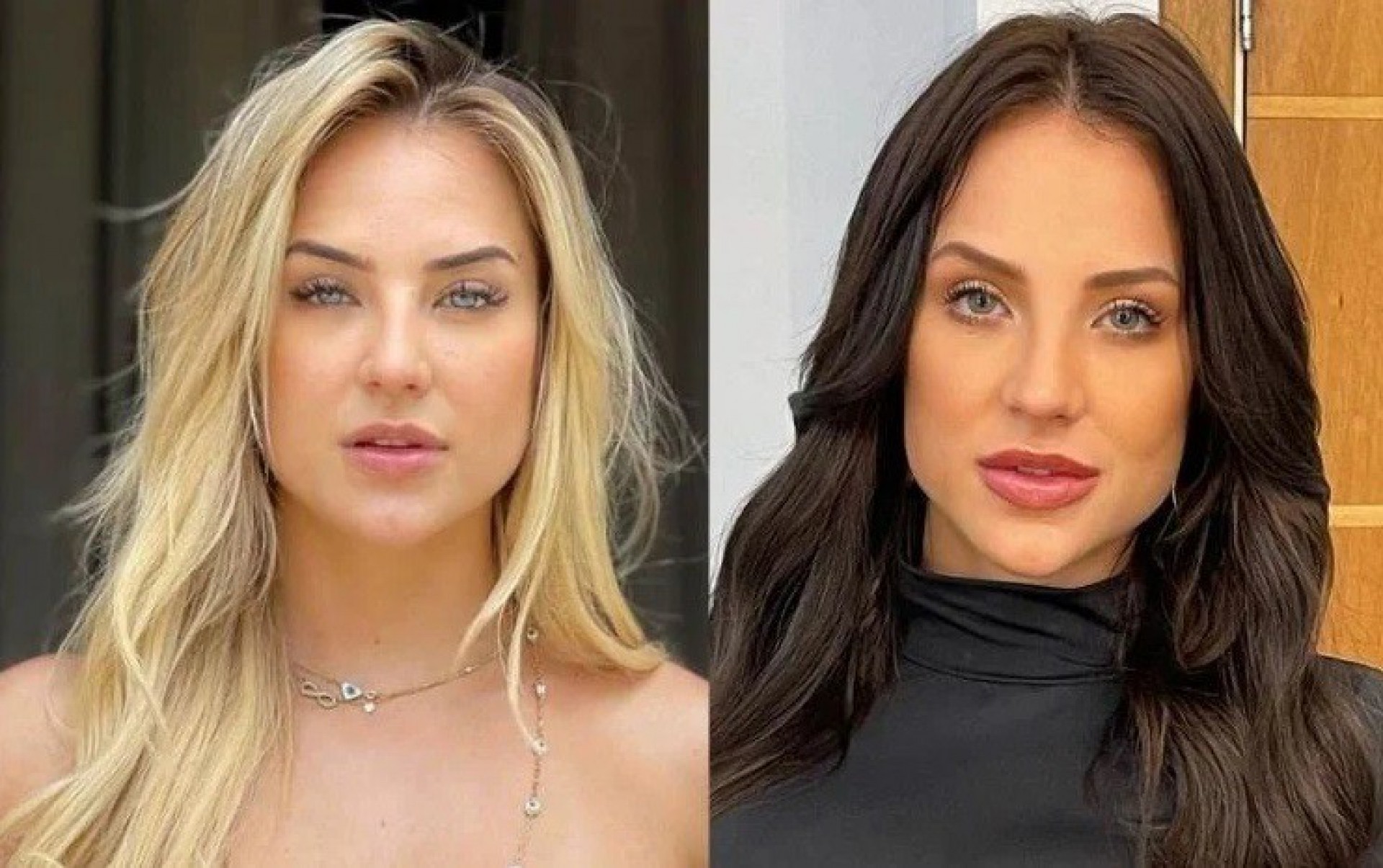 Antes e depois dos procedimentos estéticos de Gabi Martins  - Reprodução/Internet