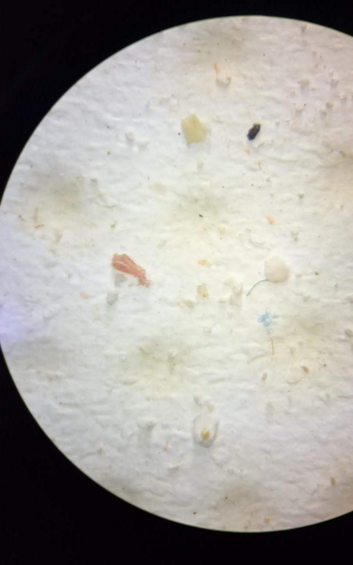 Foto de microsc&oacute;pio mostra micropl&aacute;sticos encontrados nas amostras, recolhidas pelo Grupo de Pesquisa em Ecologia Aqu&aacute;tica Experimental e Aplicada - UNIRIO